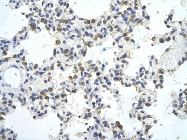 ZNF444 Antibody in Immunohistochemistry (Paraffin) (IHC (P))