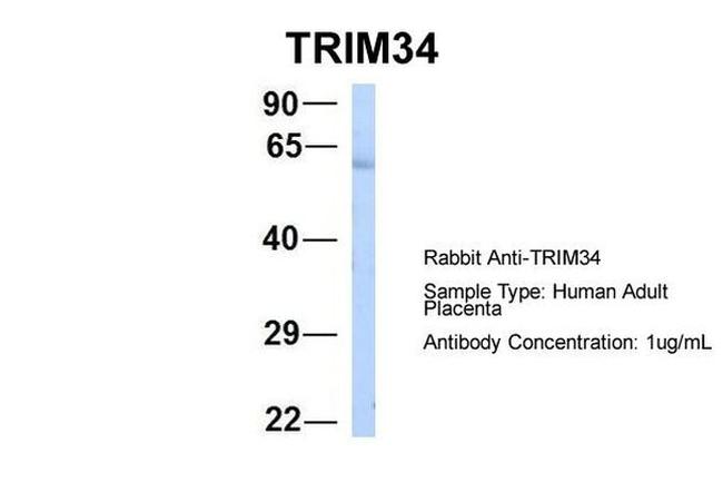 TRIM34 Antibody in Western Blot (WB)