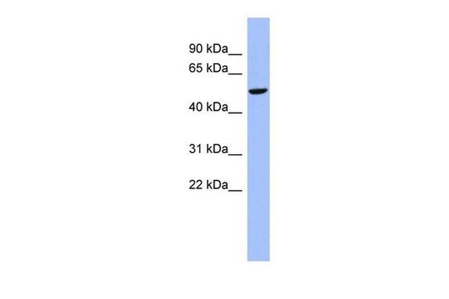 CBLL1 Antibody in Western Blot (WB)