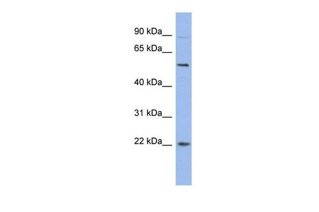 HMGB4 Antibody in Western Blot (WB)