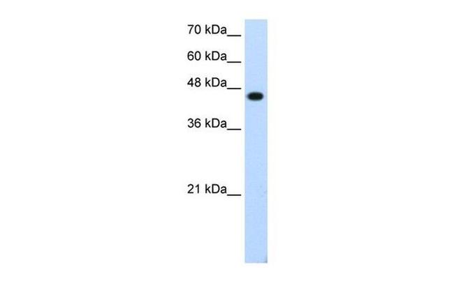 TFAP2E Antibody in Western Blot (WB)