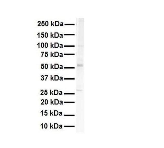 SNRNP70 Antibody in Western Blot (WB)