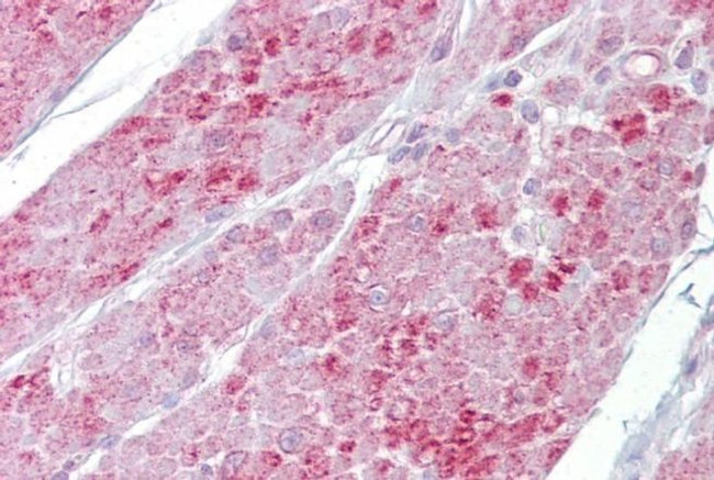 OAS1 Antibody in Immunohistochemistry (IHC)