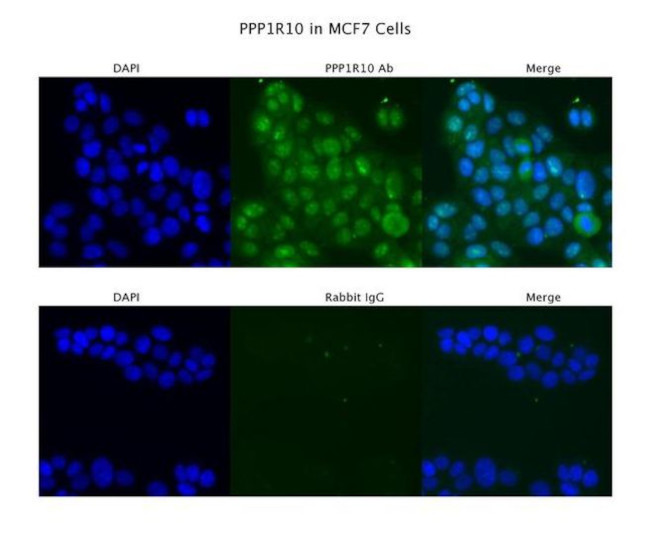 PPP1R10 Antibody in Immunocytochemistry (ICC/IF)