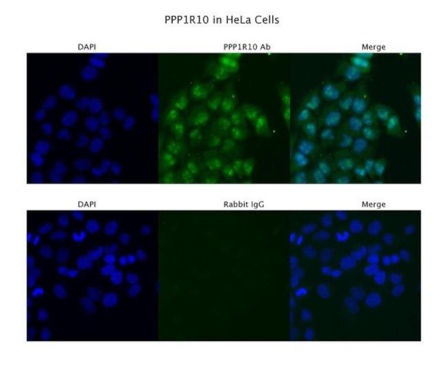 PPP1R10 Antibody in Immunocytochemistry (ICC/IF)