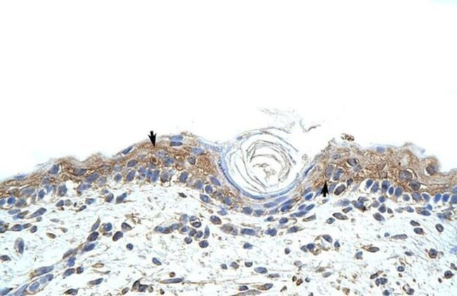 RBMS1 Antibody in Immunohistochemistry (Paraffin) (IHC (P))