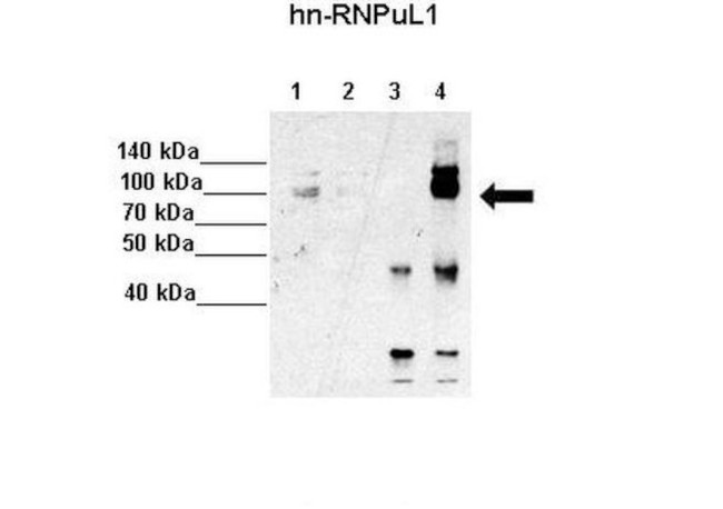 hnRNP UL1 Antibody in Immunoprecipitation (IP)