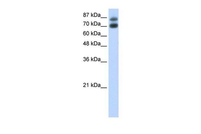 hnRNP UL1 Antibody in Western Blot (WB)