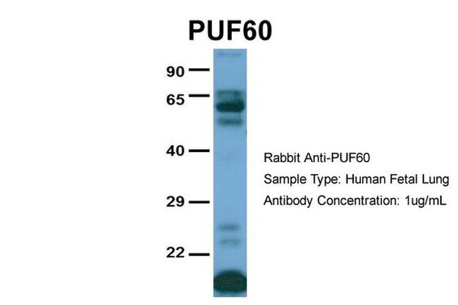 PUF60 Antibody in Western Blot (WB)