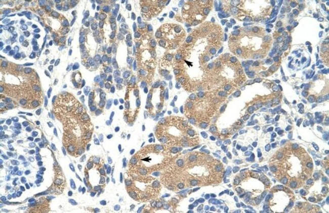 APOBEC3D Antibody in Immunohistochemistry (Paraffin) (IHC (P))