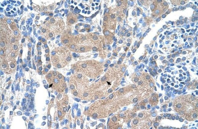 SLA/LP Antibody in Immunohistochemistry (Paraffin) (IHC (P))