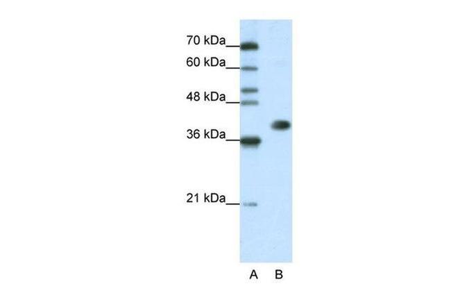 hnRNP A3 Antibody in Western Blot (WB)