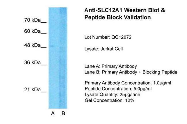 NKCC2 Antibody in Western Blot (WB)
