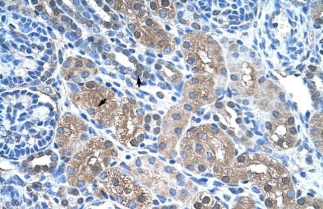 FBP1 Antibody in Immunohistochemistry (Paraffin) (IHC (P))