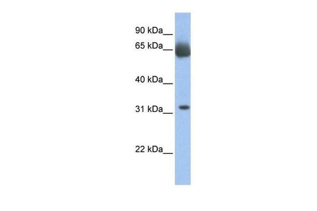 C11orf54 Antibody in Western Blot (WB)
