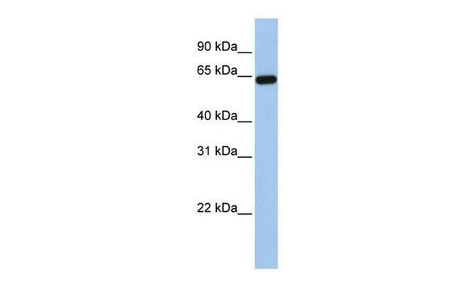 STS Antibody in Western Blot (WB)