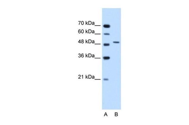 SEMG1 Antibody in Western Blot (WB)