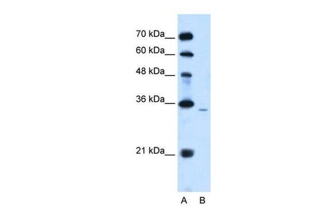 PPAP2A Antibody in Western Blot (WB)