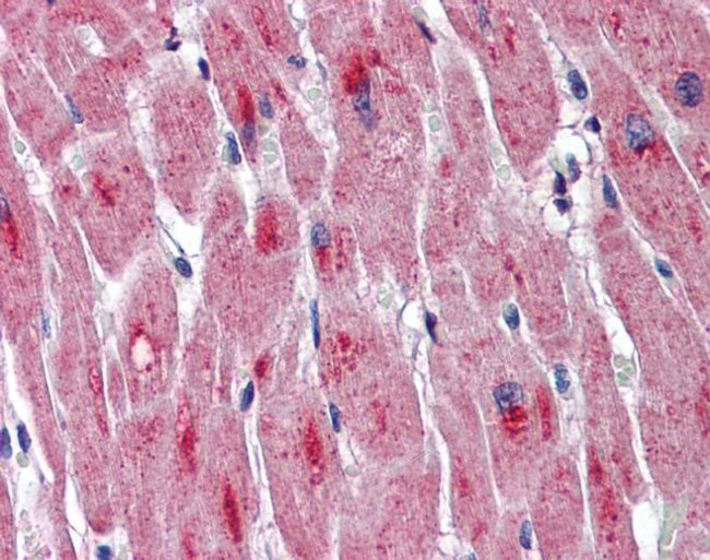 DMPK Antibody in Immunohistochemistry (IHC)