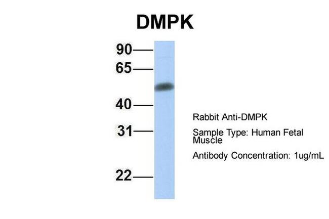 DMPK Antibody in Western Blot (WB)