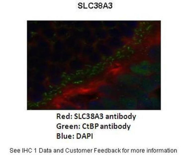 SLC38A3 Antibody in Immunohistochemistry (IHC)
