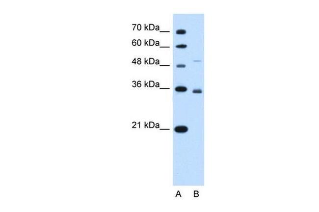 SLC38A3 Antibody in Western Blot (WB)