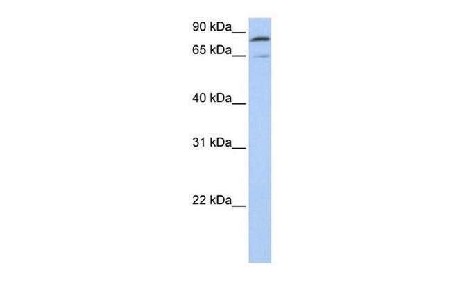 MFN2 Antibody in Western Blot (WB)