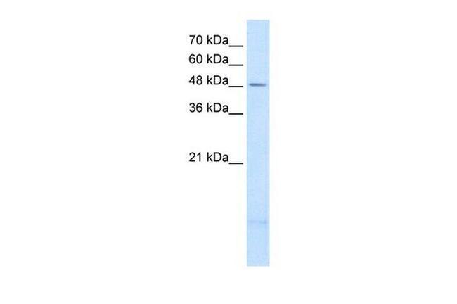 PSD3 Antibody in Western Blot (WB)