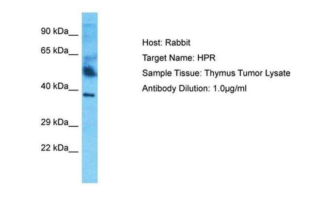 HPR Antibody in Western Blot (WB)