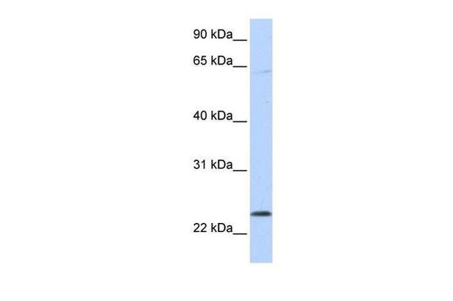 CHAC1 Antibody in Western Blot (WB)