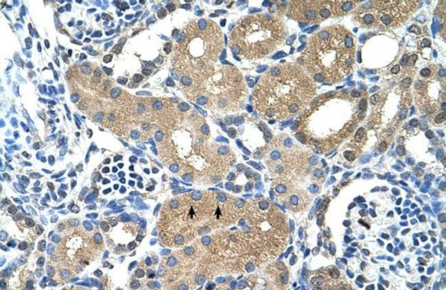 PPAP2A Antibody in Immunohistochemistry (IHC)