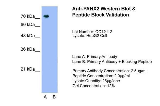 Pannexin 2 Antibody in Western Blot (WB)