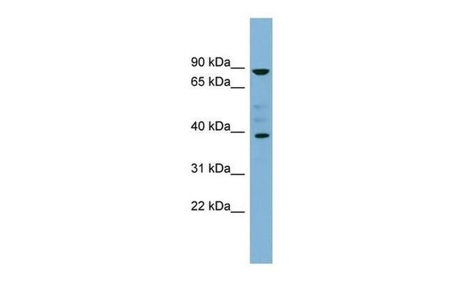 MARCH8 Antibody in Western Blot (WB)