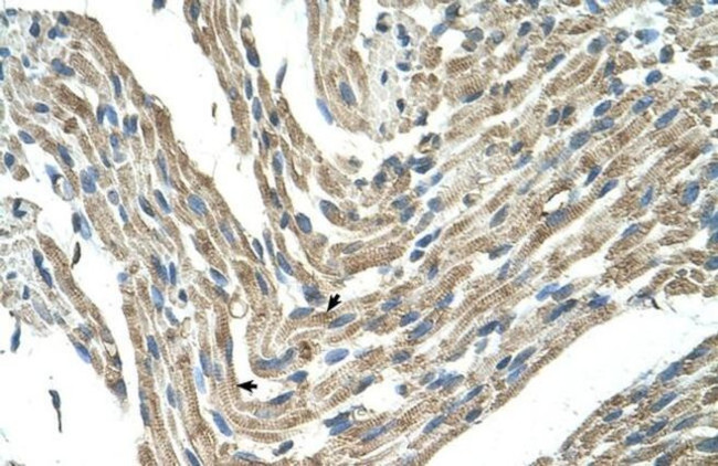 FBXL5 Antibody in Immunohistochemistry (IHC)