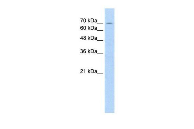 FBXL5 Antibody in Western Blot (WB)