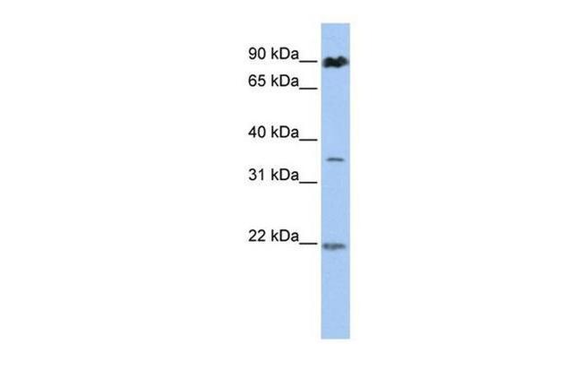 C13orf7 Antibody in Western Blot (WB)