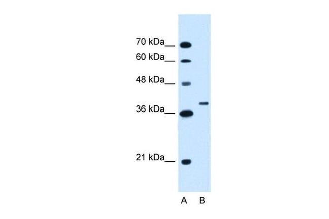 RNF146 Antibody in Western Blot (WB)