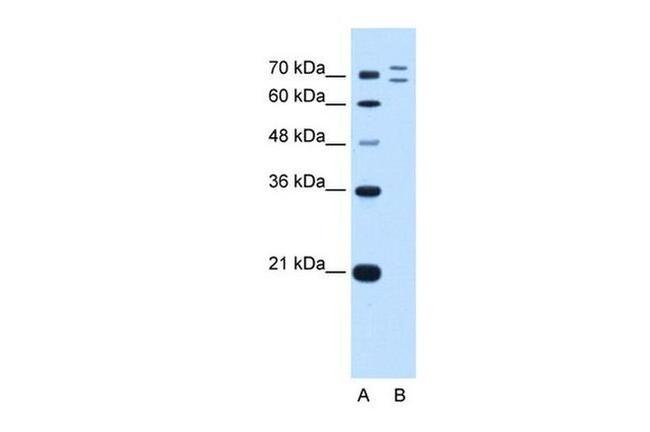 RNF168 Antibody in Western Blot (WB)