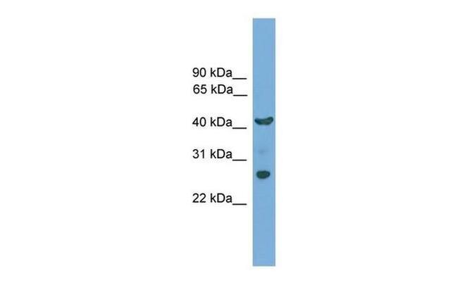 TMEM176A Antibody in Western Blot (WB)