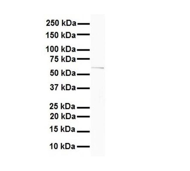 SLC7A1 Antibody in Western Blot (WB)