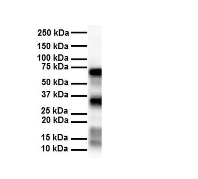 SLC25A12 Antibody in Western Blot (WB)