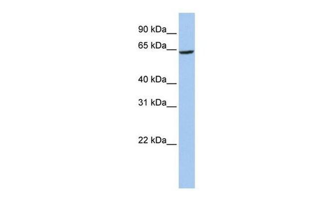 SLC13A2 Antibody in Western Blot (WB)