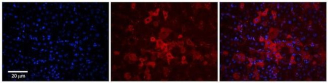 OATP1 Antibody in Immunohistochemistry (Paraffin) (IHC (P))