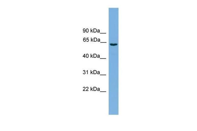 OATP1 Antibody in Western Blot (WB)