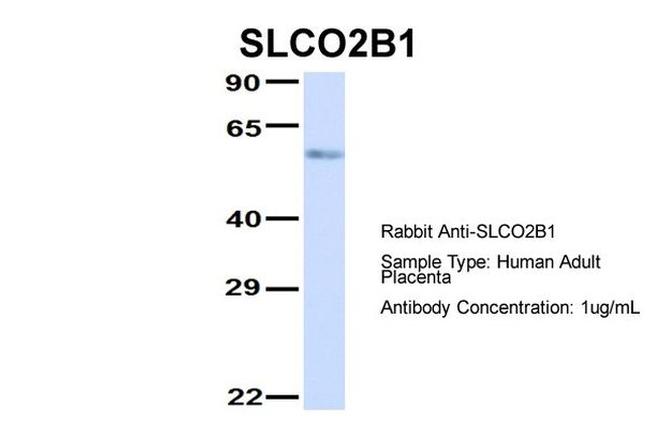 SLCO2B1 Antibody in Western Blot (WB)