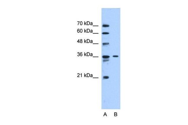 SLC35A3 Antibody in Western Blot (WB)