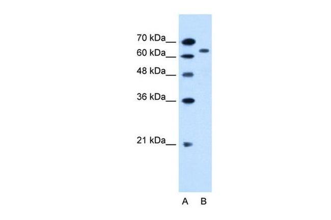 SLC22A3 Antibody in Western Blot (WB)