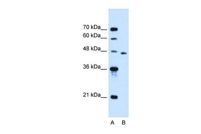 SLC16A12 Antibody in Western Blot (WB)