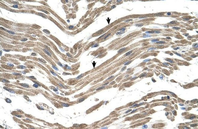 C1QB Antibody in Immunohistochemistry (IHC)