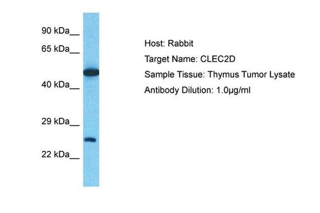 CLEC2D Antibody in Western Blot (WB)